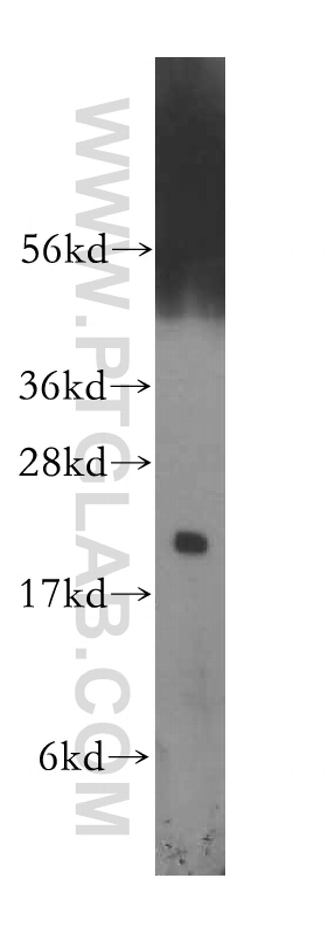 CBX3 Antibody in Western Blot (WB)