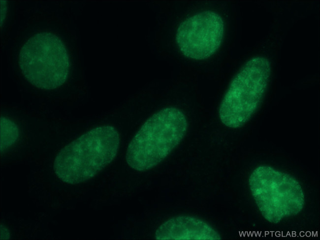 CBX3 Antibody in Immunocytochemistry (ICC/IF)