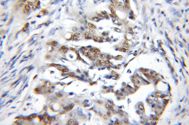 CBX3 Antibody in Immunohistochemistry (Paraffin) (IHC (P))