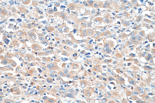 AP4M1 Antibody in Immunohistochemistry (Paraffin) (IHC (P))