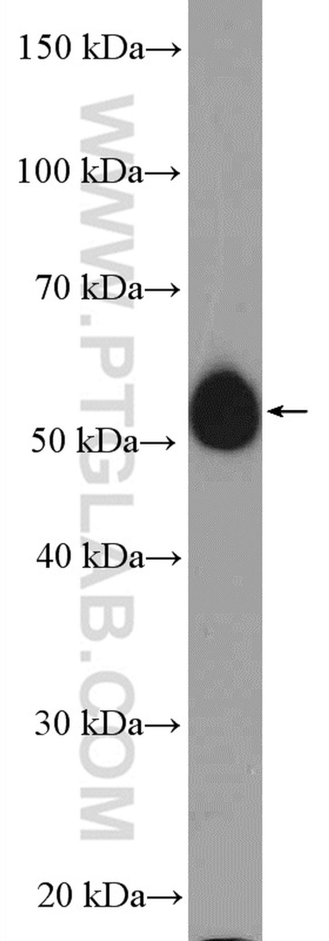 AP4M1 Antibody in Western Blot (WB)