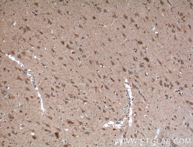 MCHR1 Antibody in Immunohistochemistry (Paraffin) (IHC (P))