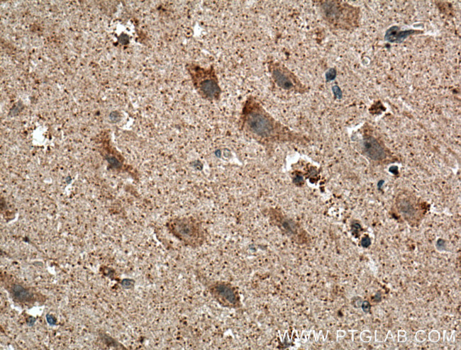 MCHR1 Antibody in Immunohistochemistry (Paraffin) (IHC (P))