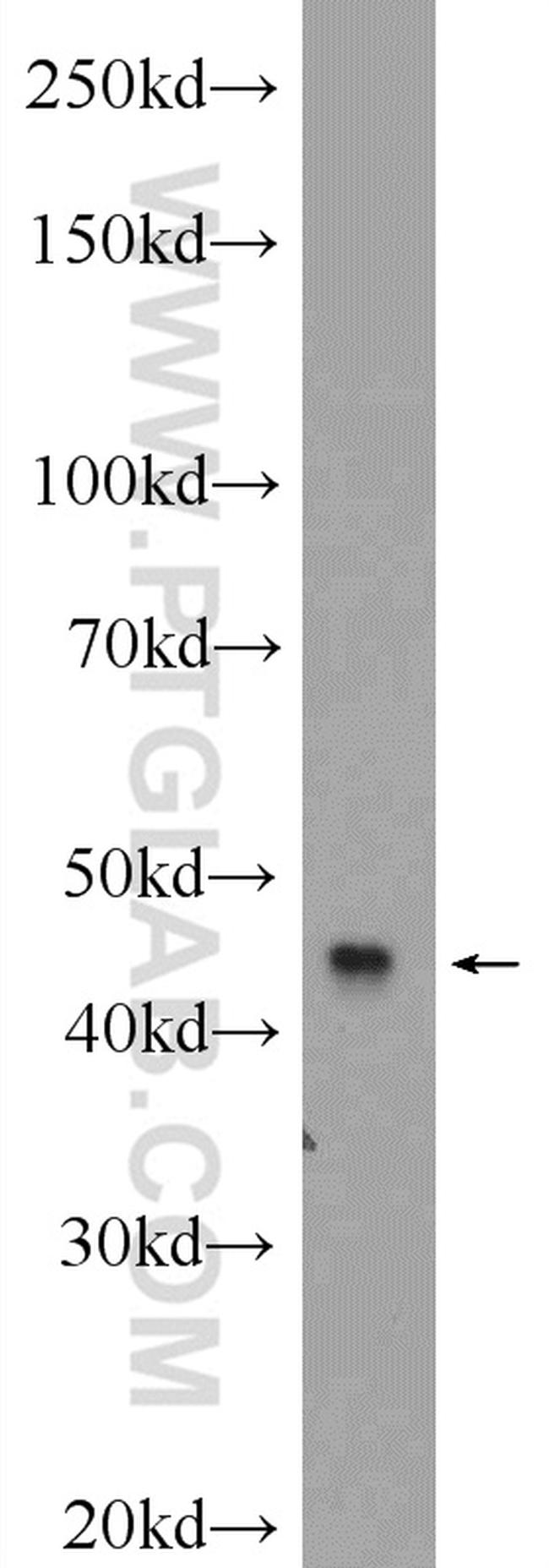 MCHR1 Antibody in Western Blot (WB)