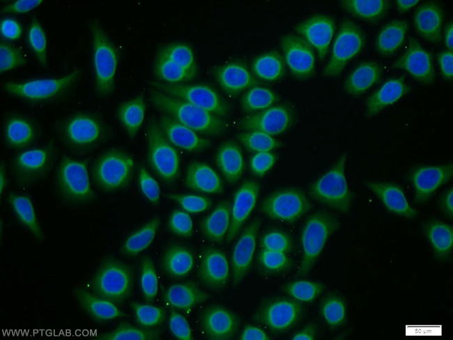 CPI17 Antibody in Immunocytochemistry (ICC/IF)