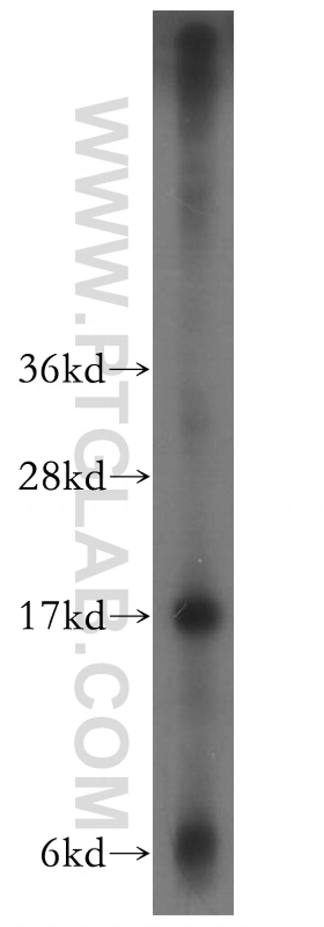 CPI17 Antibody in Western Blot (WB)