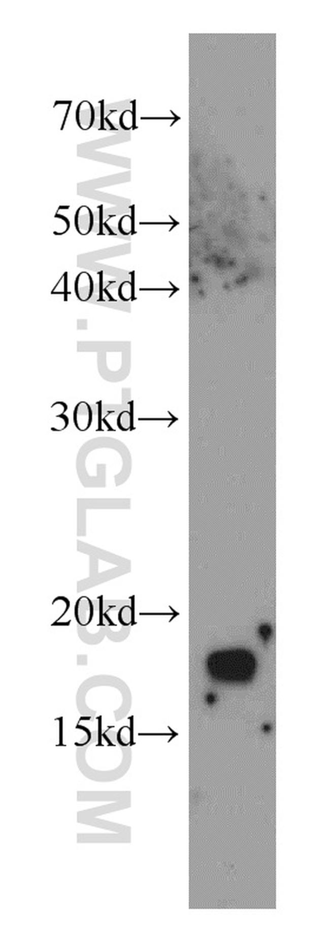 CPI17 Antibody in Western Blot (WB)