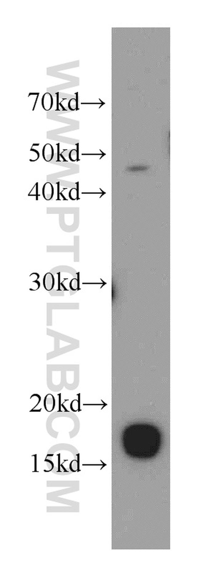 CPI17 Antibody in Western Blot (WB)