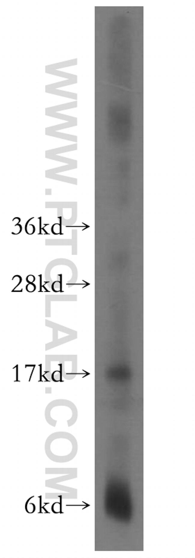 CPI17 Antibody in Western Blot (WB)