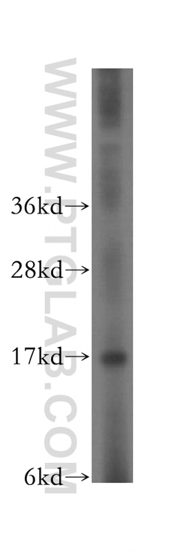 CPI17 Antibody in Western Blot (WB)