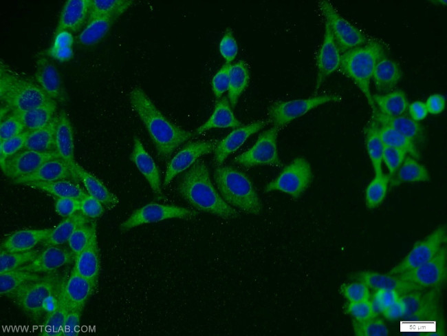 MALT1 Antibody in Immunocytochemistry (ICC/IF)