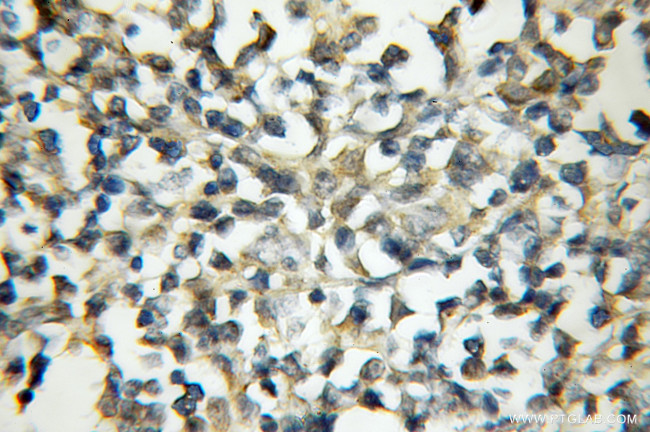 MALT1 Antibody in Immunohistochemistry (Paraffin) (IHC (P))