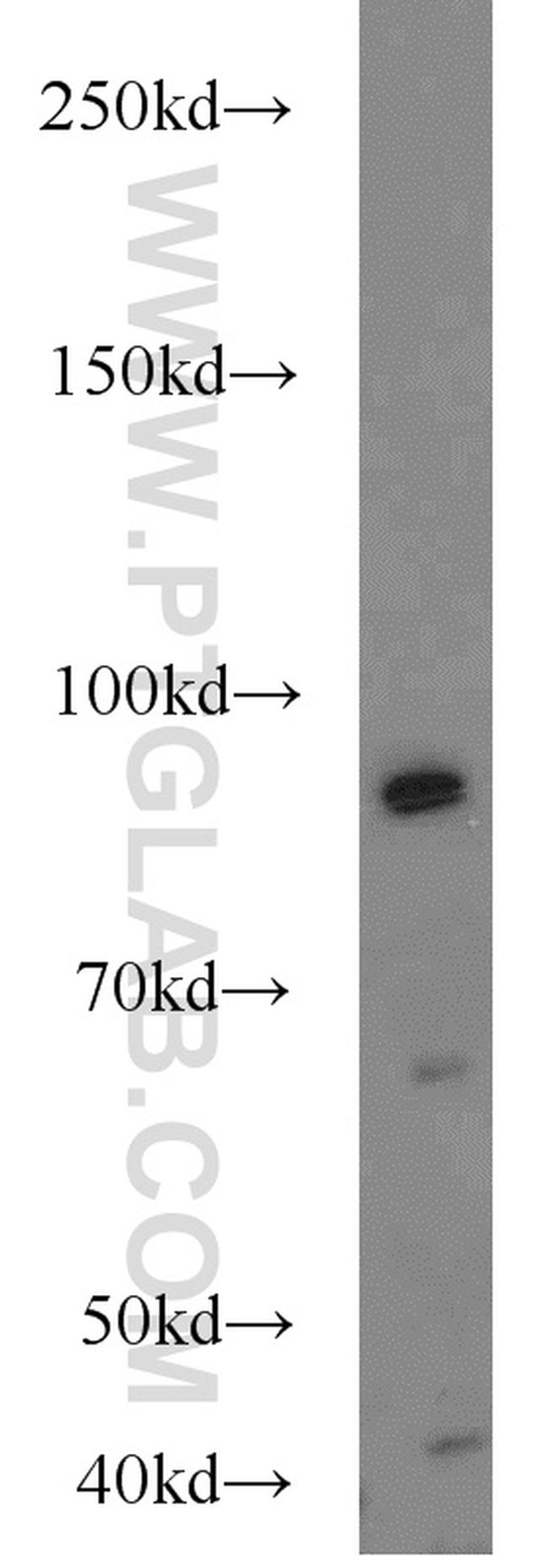 MALT1 Antibody in Western Blot (WB)