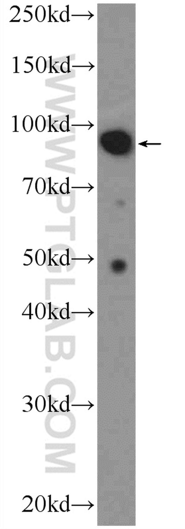 MALT1 Antibody in Western Blot (WB)