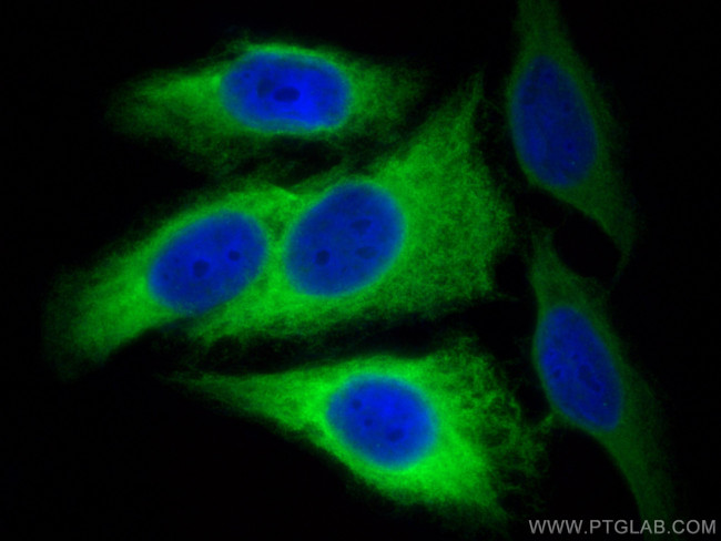 RRM2 Antibody in Immunocytochemistry (ICC/IF)