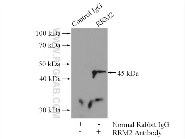 RRM2 Antibody in Immunoprecipitation (IP)