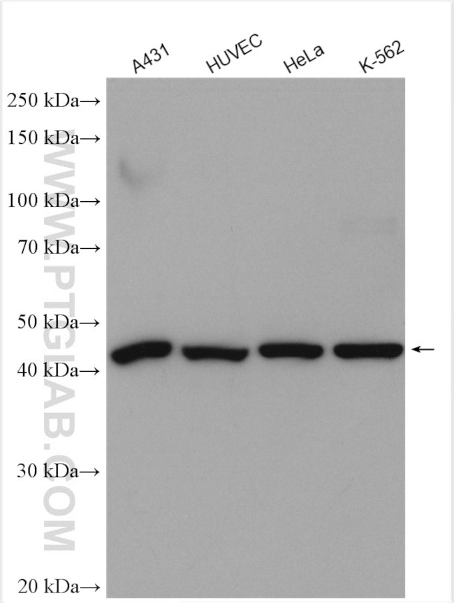 RRM2 Antibody in Western Blot (WB)