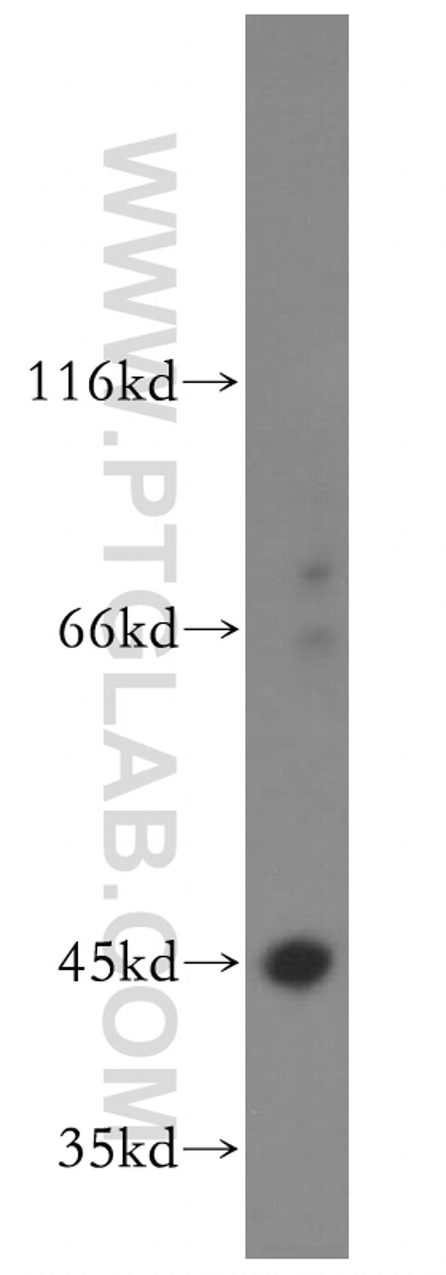 RRM2 Antibody in Western Blot (WB)