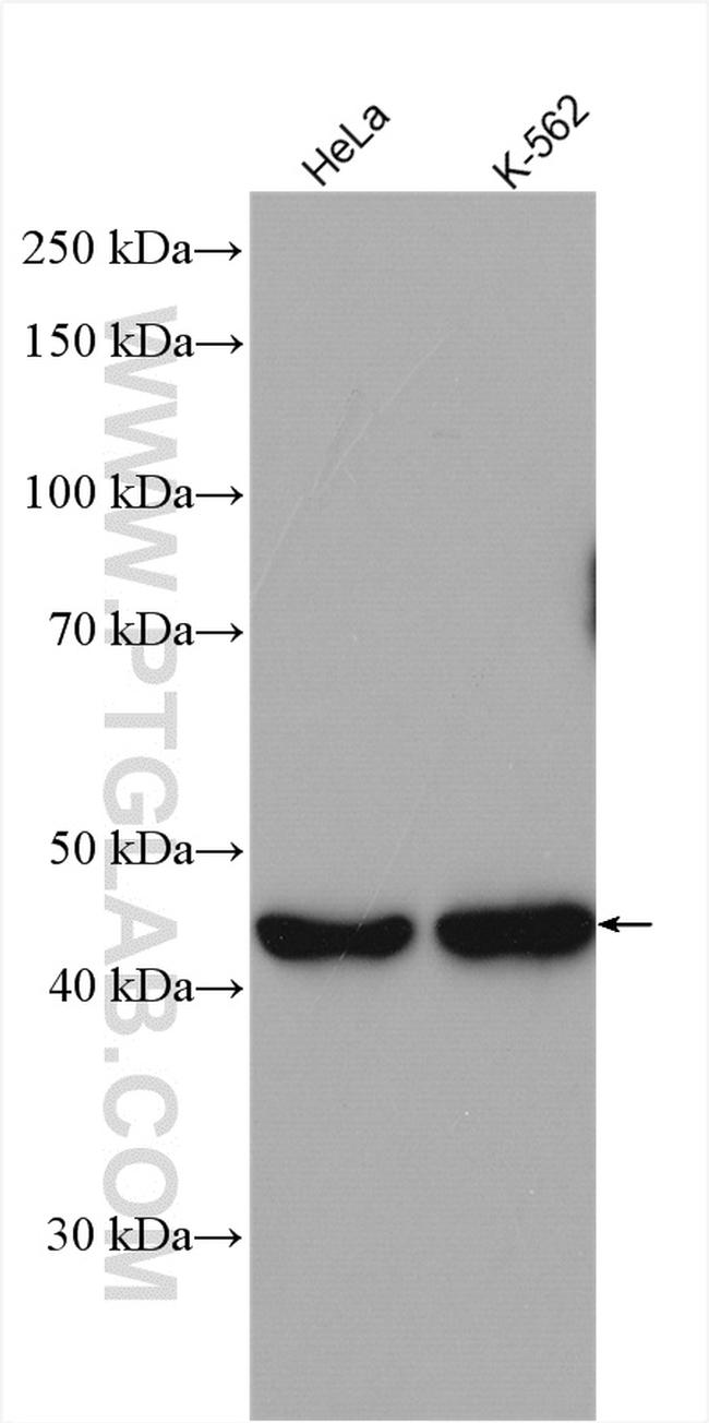 RRM2 Antibody in Western Blot (WB)