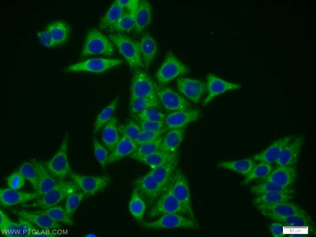 VPS52 Antibody in Immunocytochemistry (ICC/IF)