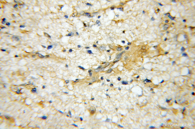 VPS52 Antibody in Immunohistochemistry (Paraffin) (IHC (P))