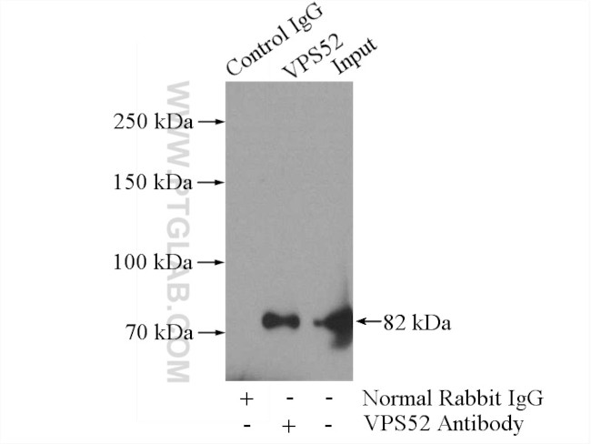 VPS52 Antibody in Immunoprecipitation (IP)