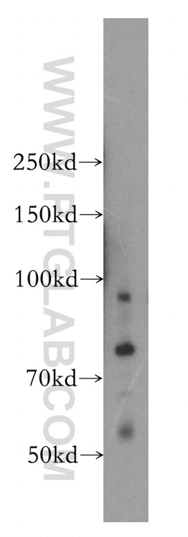 VPS52 Antibody in Western Blot (WB)