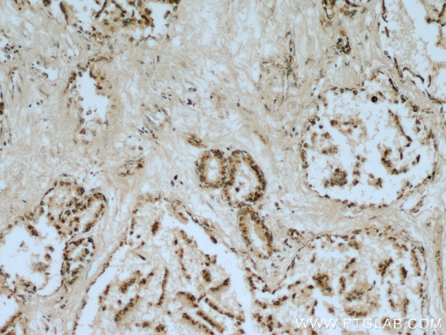 VDAC2 Antibody in Immunohistochemistry (Paraffin) (IHC (P))