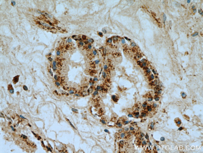 VDAC2 Antibody in Immunohistochemistry (Paraffin) (IHC (P))