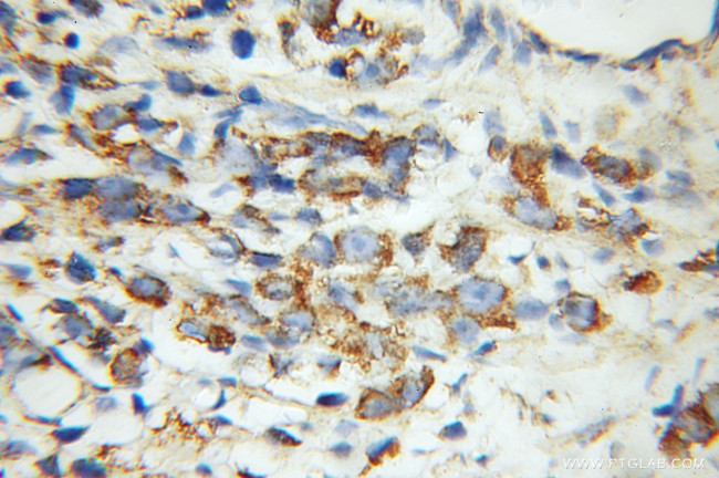 VDAC2 Antibody in Immunohistochemistry (Paraffin) (IHC (P))