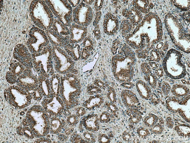 VDAC2 Antibody in Immunohistochemistry (Paraffin) (IHC (P))