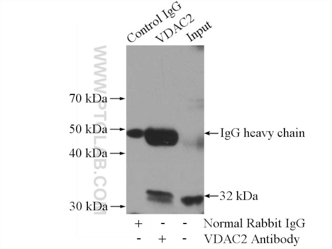 VDAC2 Antibody in Immunoprecipitation (IP)