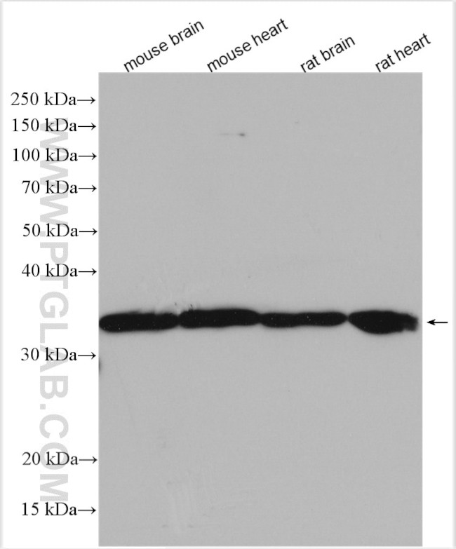 VDAC2 Antibody in Western Blot (WB)