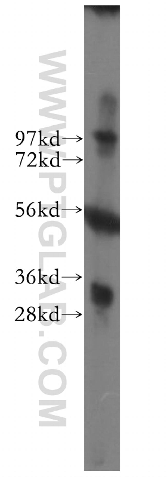 VDAC2 Antibody in Western Blot (WB)