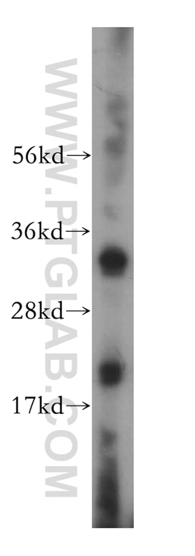 VDAC2 Antibody in Western Blot (WB)