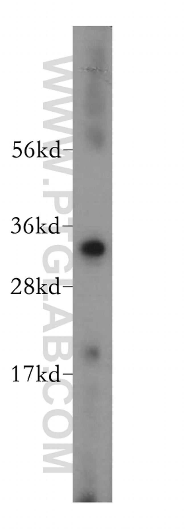 VDAC2 Antibody in Western Blot (WB)