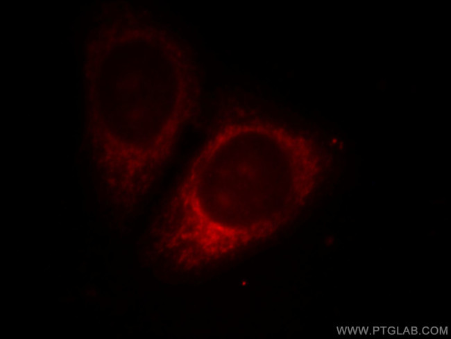 WSB1 Antibody in Immunocytochemistry (ICC/IF)