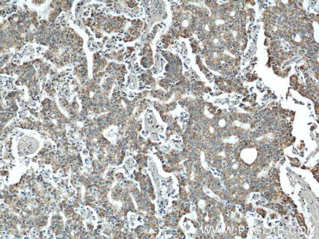 WSB1 Antibody in Immunohistochemistry (Paraffin) (IHC (P))