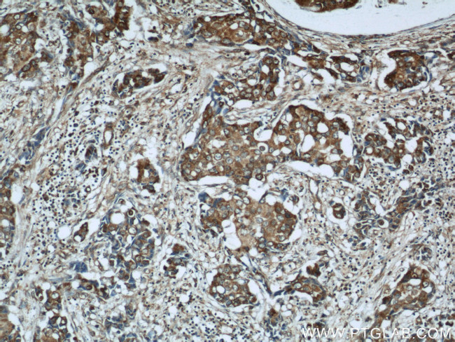 WSB1 Antibody in Immunohistochemistry (Paraffin) (IHC (P))