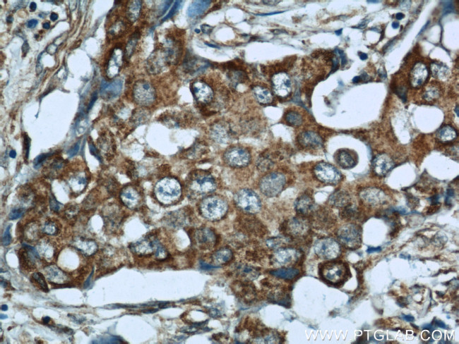 WSB1 Antibody in Immunohistochemistry (Paraffin) (IHC (P))