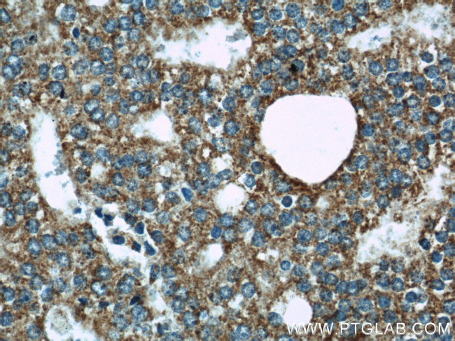 WSB1 Antibody in Immunohistochemistry (Paraffin) (IHC (P))