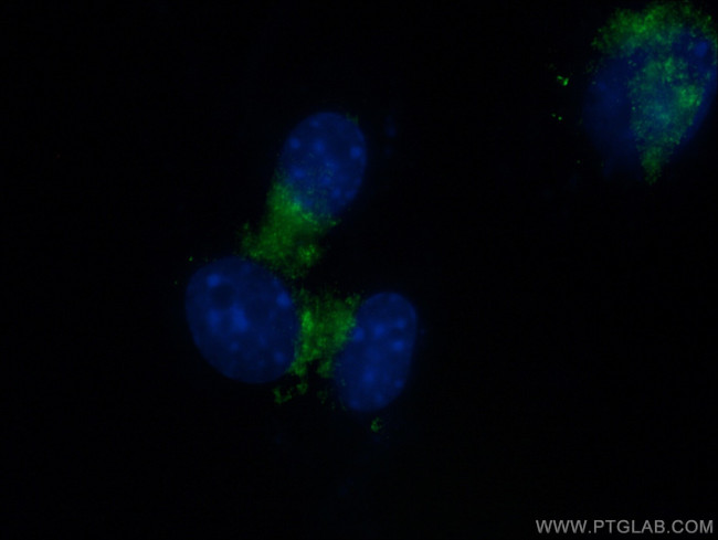 RAB1A Antibody in Immunocytochemistry (ICC/IF)