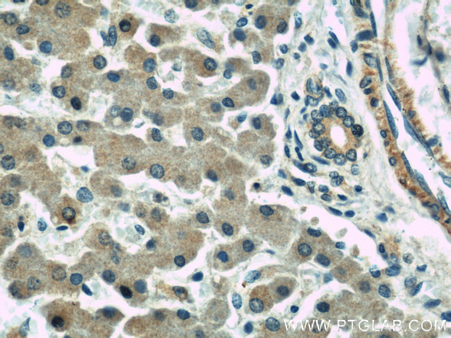 RAB1A Antibody in Immunohistochemistry (Paraffin) (IHC (P))