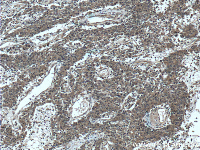 RAB1A Antibody in Immunohistochemistry (Paraffin) (IHC (P))