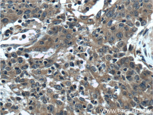 RAB1A Antibody in Immunohistochemistry (Paraffin) (IHC (P))