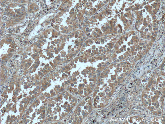 RAB1A Antibody in Immunohistochemistry (Paraffin) (IHC (P))