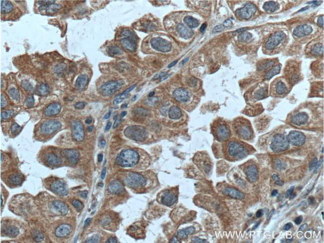 RAB1A Antibody in Immunohistochemistry (Paraffin) (IHC (P))