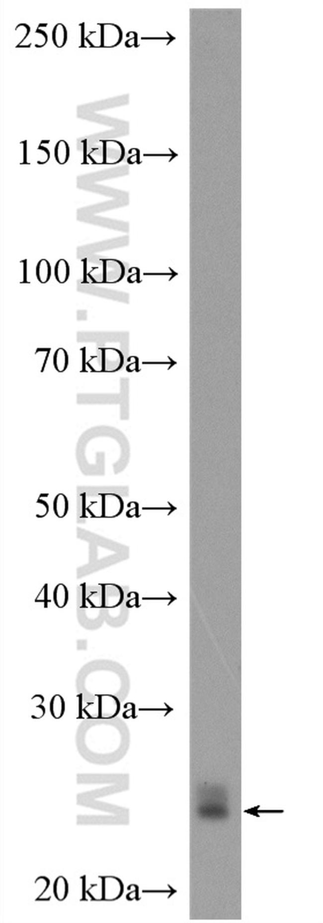 RAB1A Antibody in Western Blot (WB)