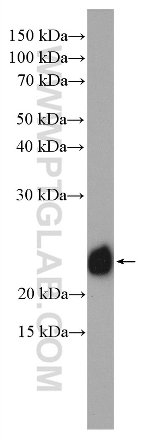 RAB1A Antibody in Western Blot (WB)