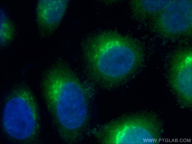 ARF4 Antibody in Immunocytochemistry (ICC/IF)